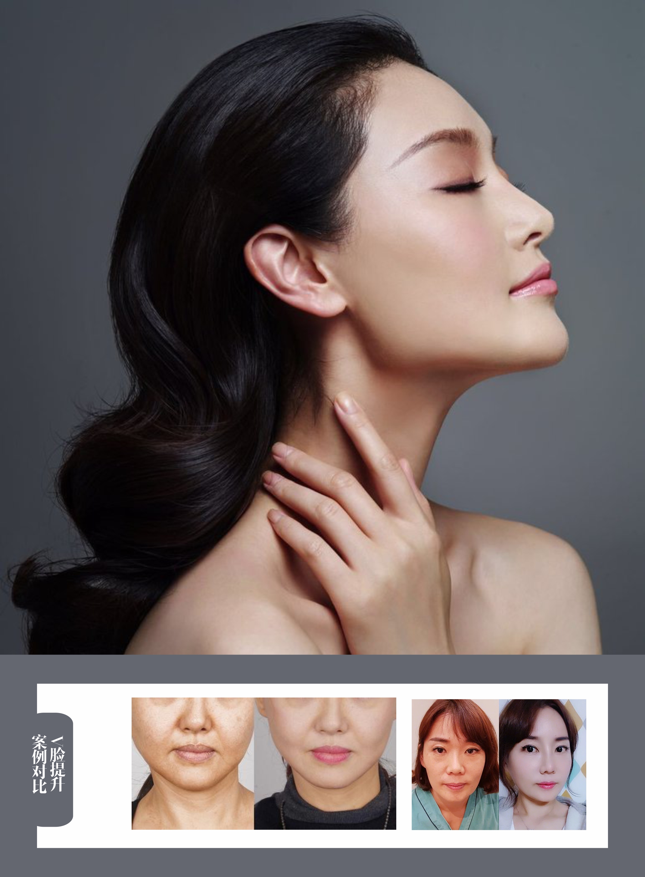 💉 Tiêm filler thẩm mỹ